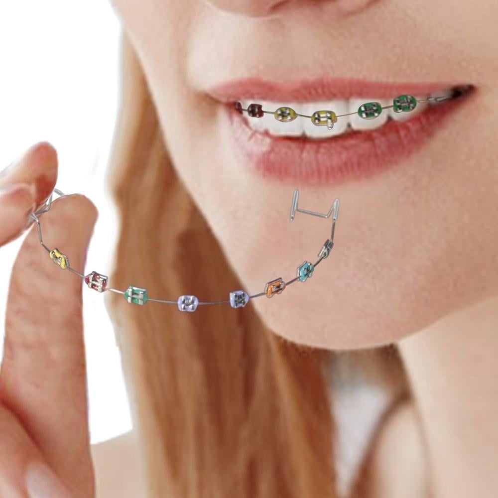 GoldCister children's cute colored metal wire false braces