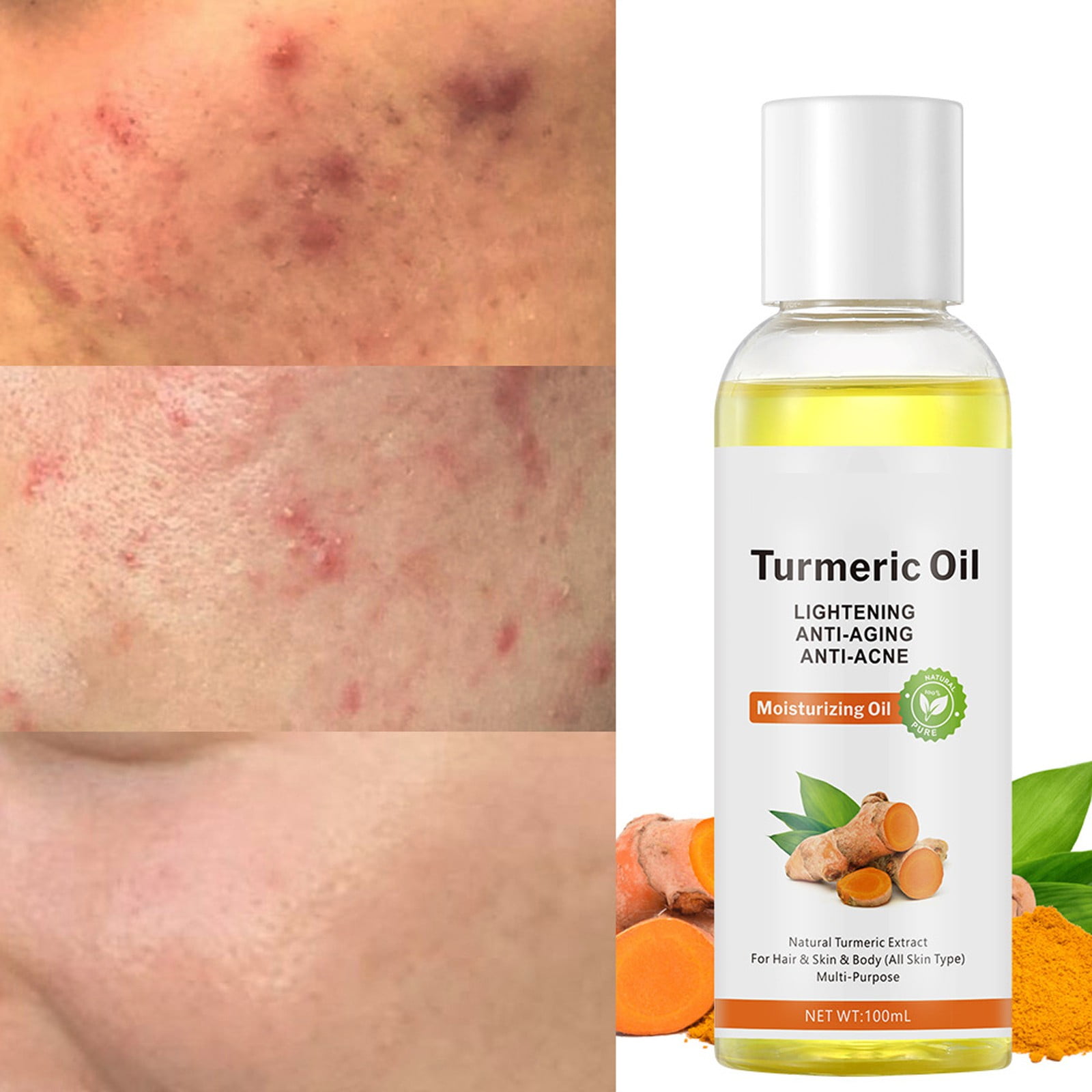 Good Discoloration Correcting Brunt Peach Slices Eye And Firming