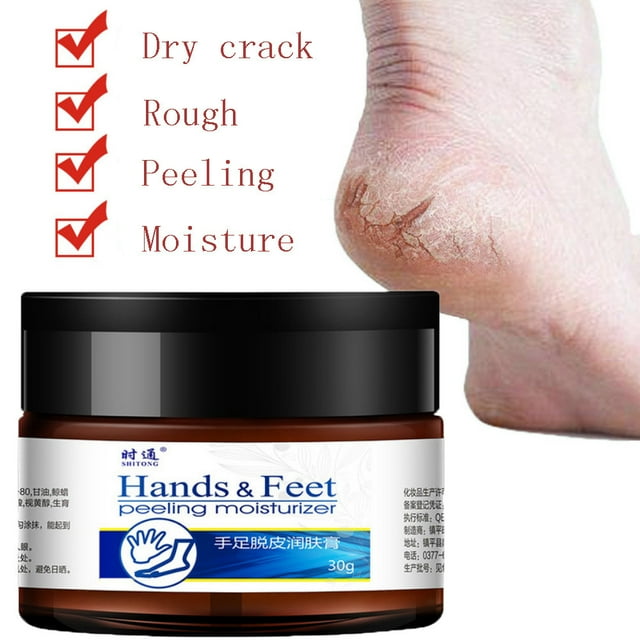 Gotyou Hand And Foot Moisturizing Cream To Prevent Dry Cracking Feet