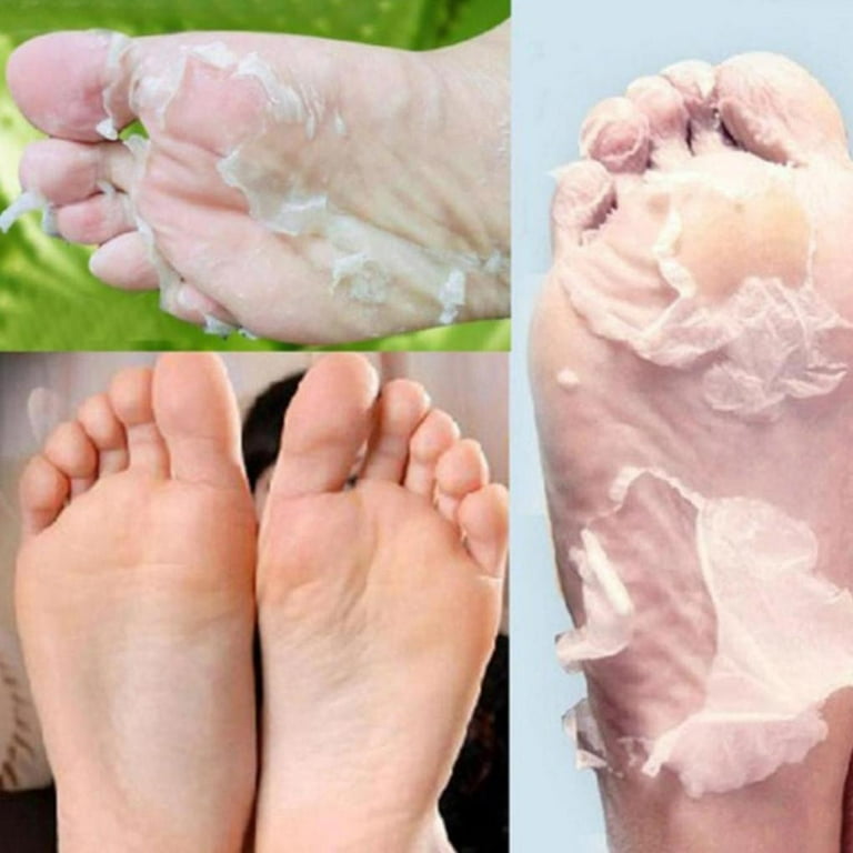 Gotyou Papaya Hot Remove Dead Skin Foot Mask Peeling Cuticles Heel Feet  Care Anti Aging 
