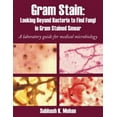 thumbnail image 1 of Gram Stain: Looking Beyond Bacteria to Find Fungi in Gram Stained Smear: A laboratory guide for medical microbiology, 9781438960289, Paperback,, 1 of 1