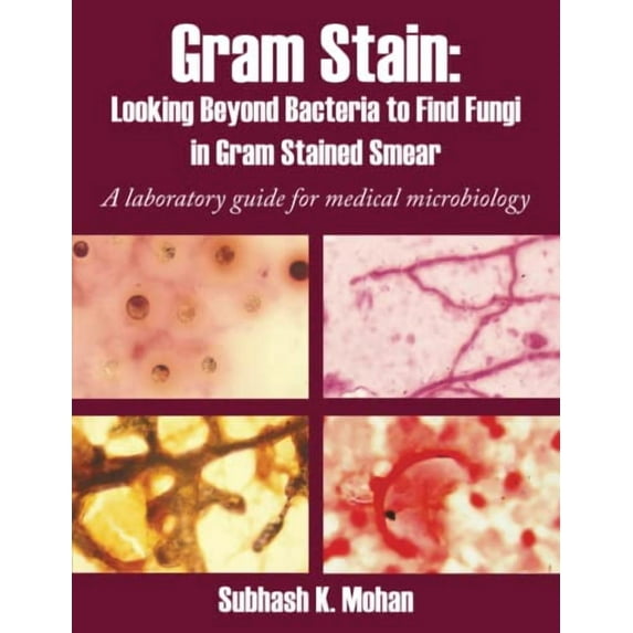 Gram Stain: Looking Beyond Bacteria to Find Fungi in Gram Stained Smear: A laboratory guide for medical microbiology, 9781438960289, Paperback,