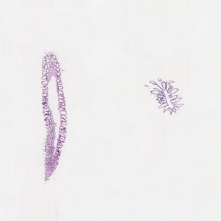 Grantia, C.S. And L.S. Microscope Slide
