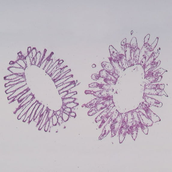 Grantia (Scypha), C.S. Microscope Slide