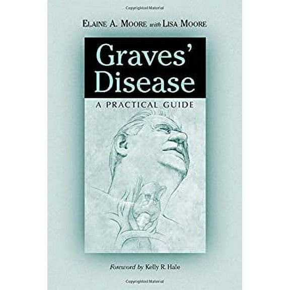 Pre-Owned Graves' Disease: A Practical Guide (Paperback) 0786410116 9780786410118