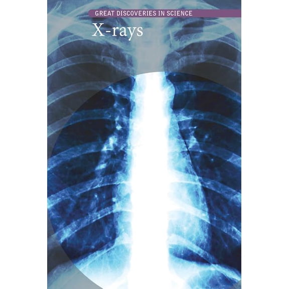 Great Discoveries in Science: X-Rays (Hardcover)