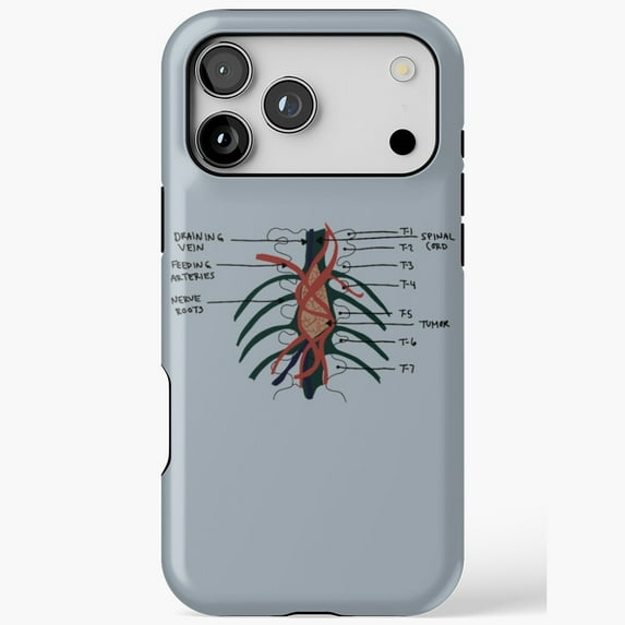 Greys Anatomy Tumor On The Wall Phone Cover for iPhone 11 12 13 14 15 16 17 Pro Max