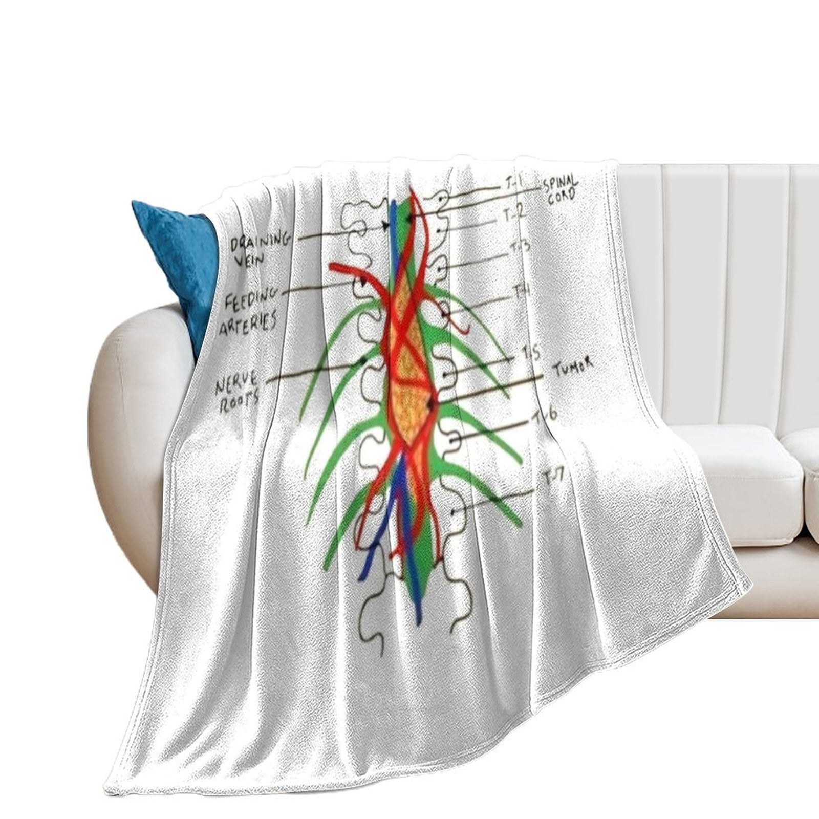 Greys Spinal tumour Throw Blanket for winter Plush Blankets