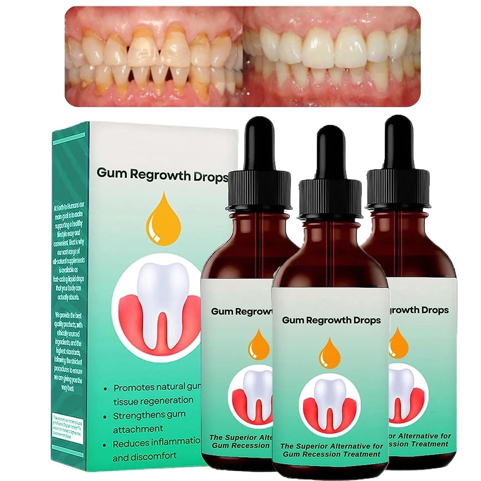 Gum Regrowth Drops, Gum Treatment for Receding Gums, Oil Pulling for
