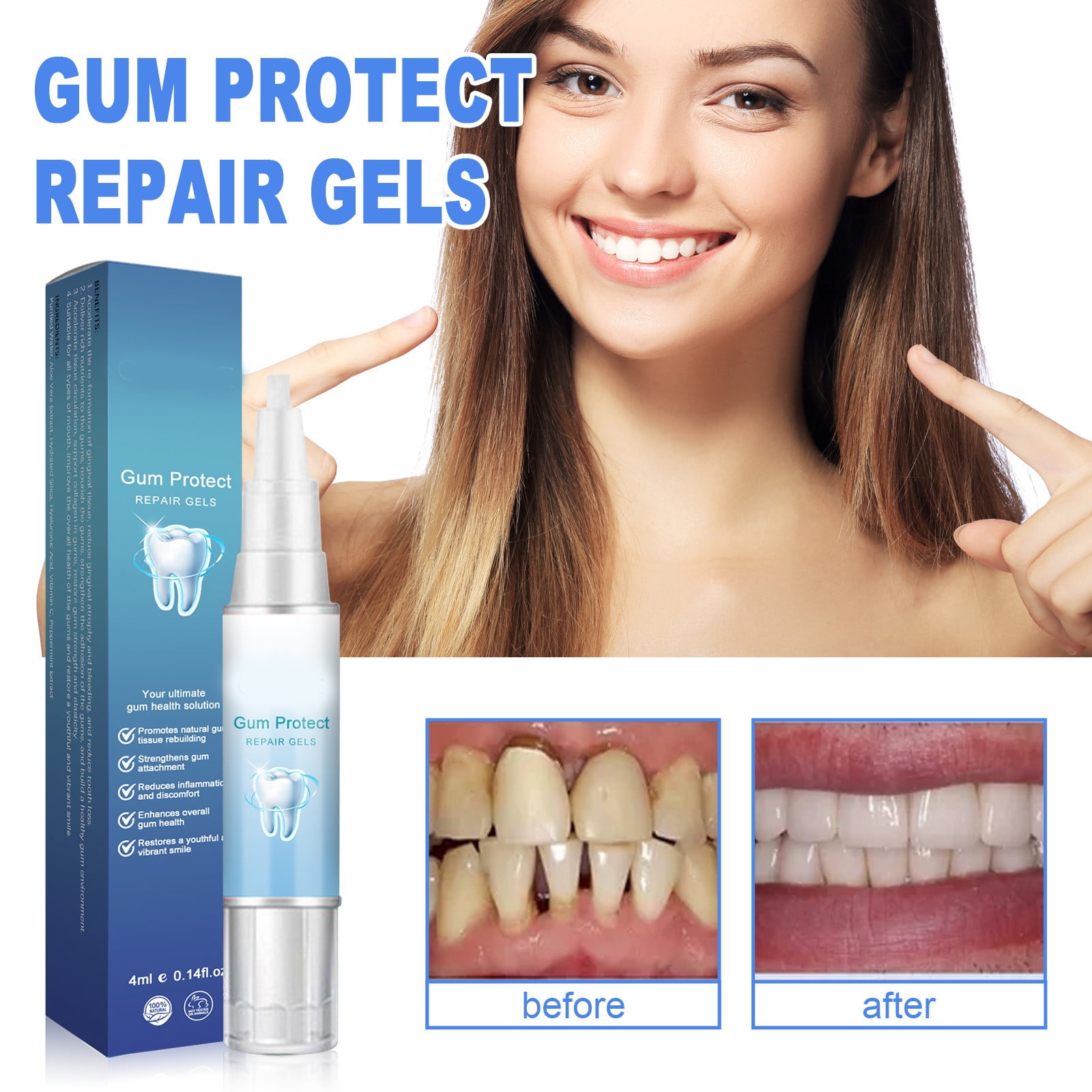 Gum Shield Nursing Gel Gum Shield Nursing Gel Teeth Blanch Concentrate Pen Teeth Blanch Gel