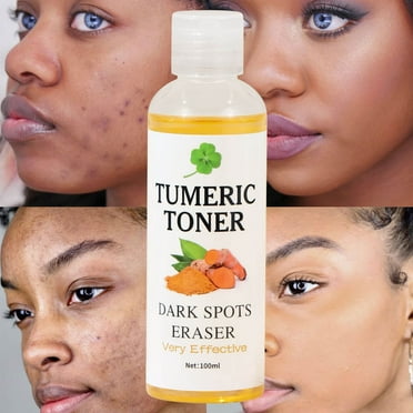 Gunyslmo Toner for Turmeric Corrector Toner, Facial Toner for Acne Prone Skin,Remover for Face Hydrating Face Toner for Women, Moisturizing Toner Face for Dry Oily Skin 100ml