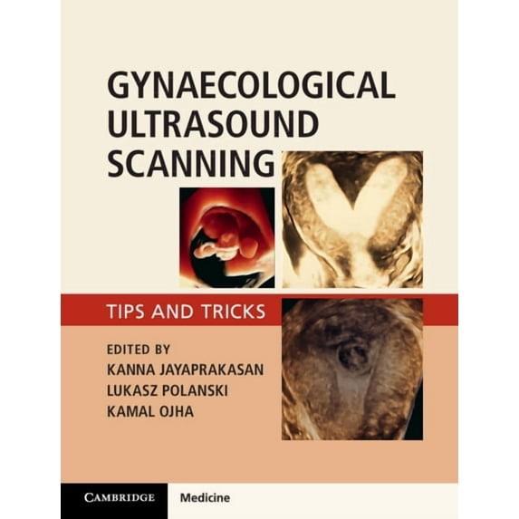 Gynaecological Ultrasound Scanning: Tips and Tricks, (Paperback)