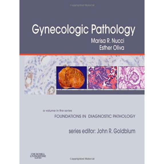 Pre-Owned Gynecologic Pathology: A Volume in Foundations in Diagnostic Pathology Series (Foundations in Diagnostic Pathology): A Volume in the Series: Foundations in Diagnostic Pathology Paperback