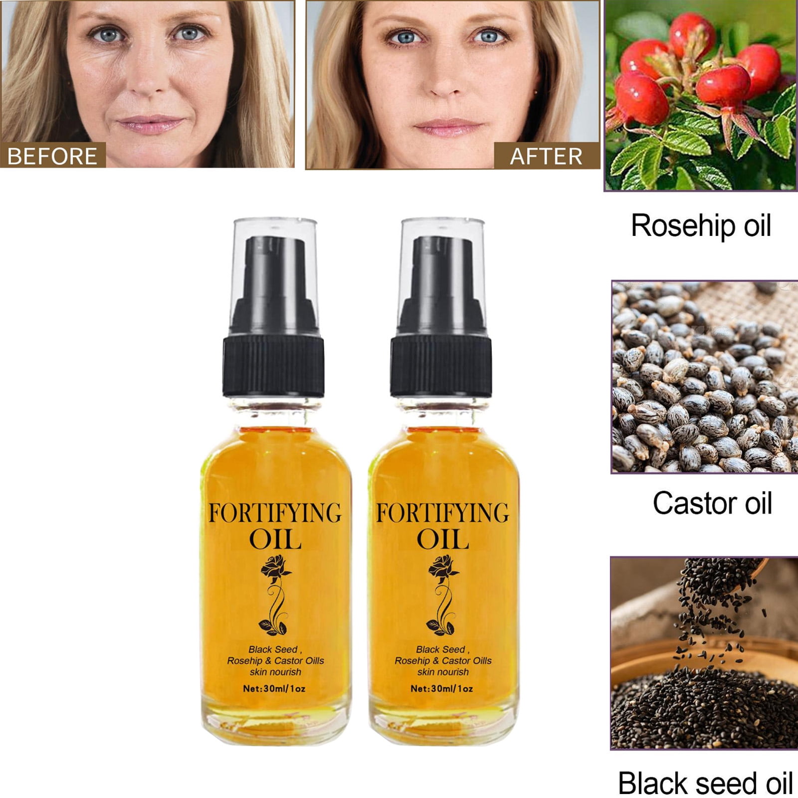 Gzwccvsn 2PCS Castor Oil for Face, Castor Oil Black Seed Oil Rosehip
