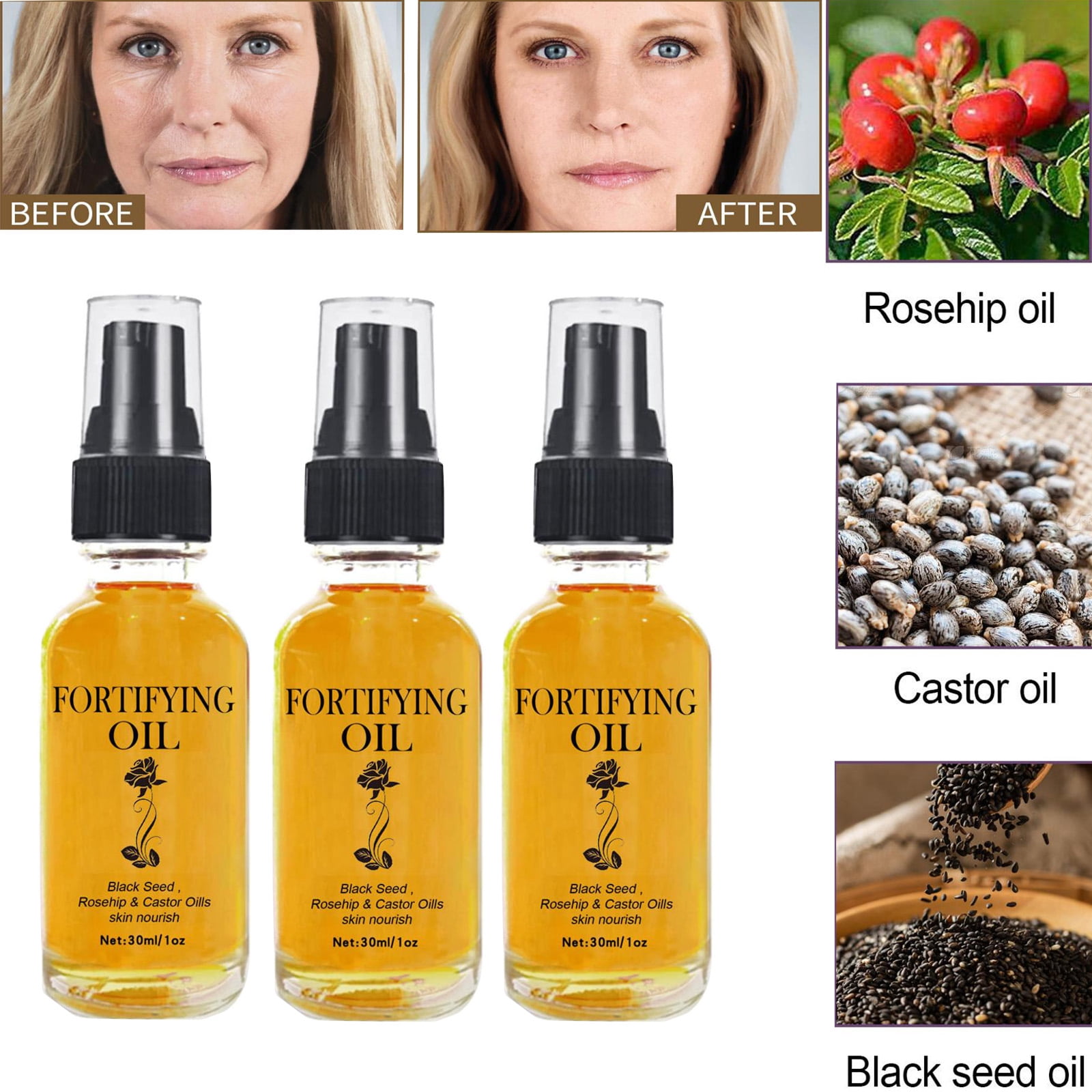 Castor oil face serum antiacne hydration and antibacterial serum ginax store