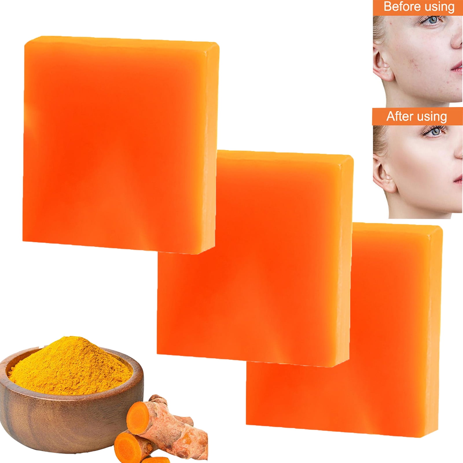 Gzwccvsn 3PCS Turmeric Soap Bar, Organic Turmeric Soap for Dark Spots