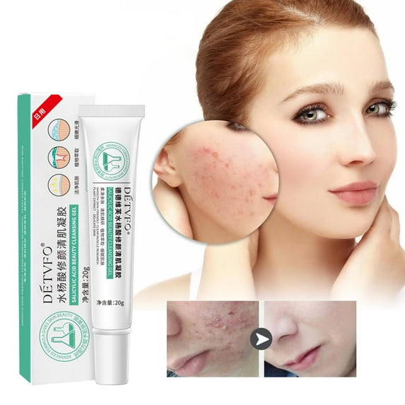 Gzwccvsn Clear Face And Acne-relieving Cream, Fade Acne Marks, Water And Oil, Acne-removing Cream