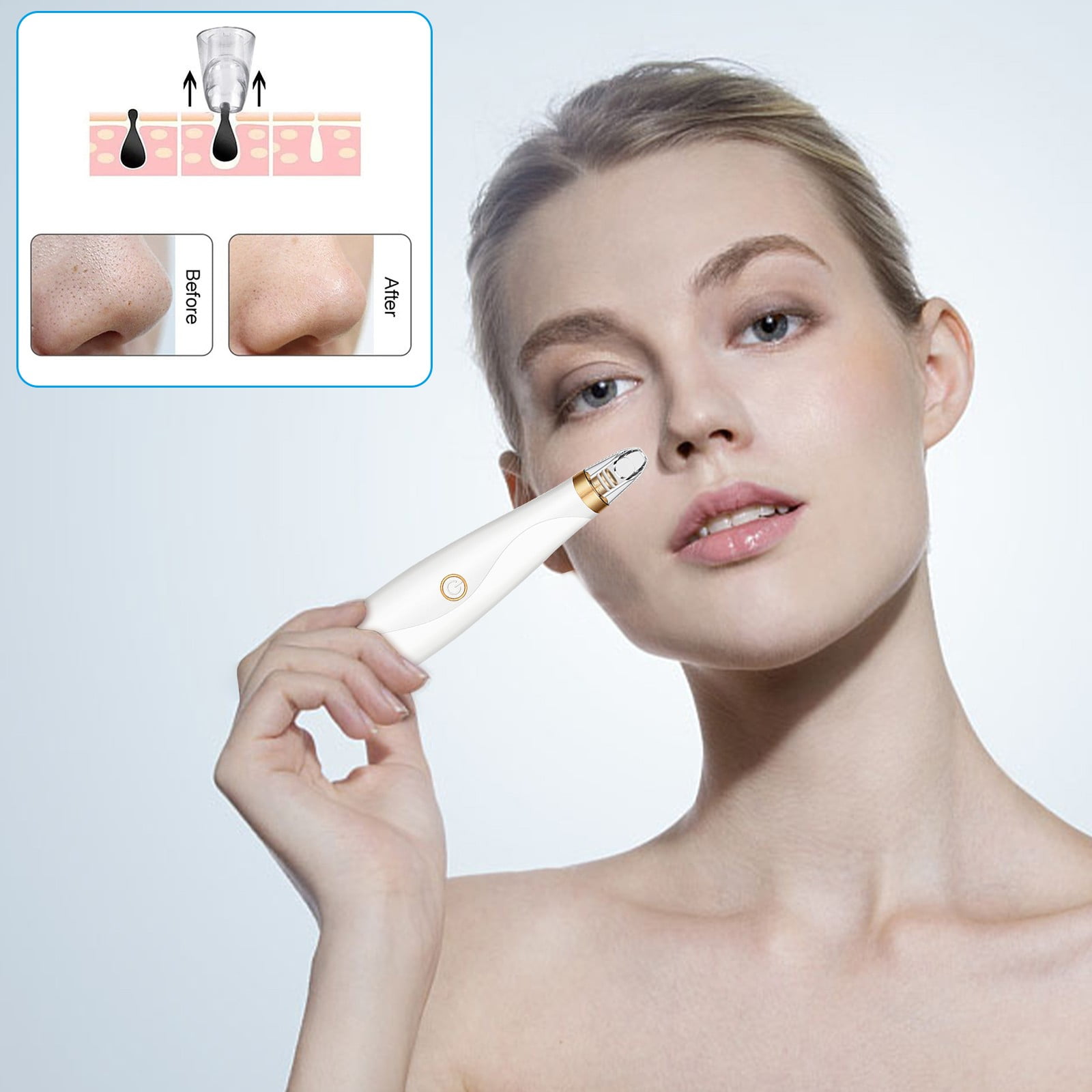 Gzwccvsn Electric Blackhead Suction Machine Pore Cleaner (including