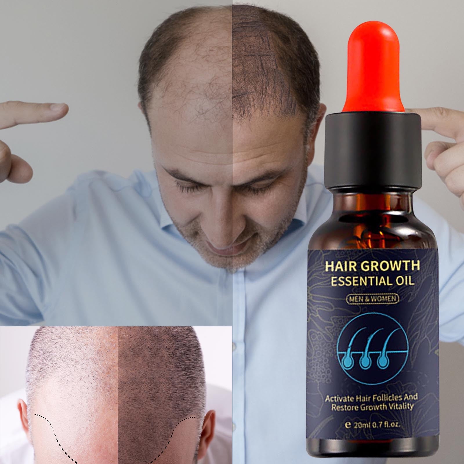 Gzwccvsn Ginger Hair Nutrient Solution Nourishes Hair To Hair Loss Hair Oil Control Hair