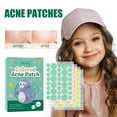 thumbnail image 1 of Gzwccvsn Pimple Patch 144 Counts Invisible Patch With Star-Shaped Spots Healing Patch Zit Patch face, body skincare korean, 1 of 8
