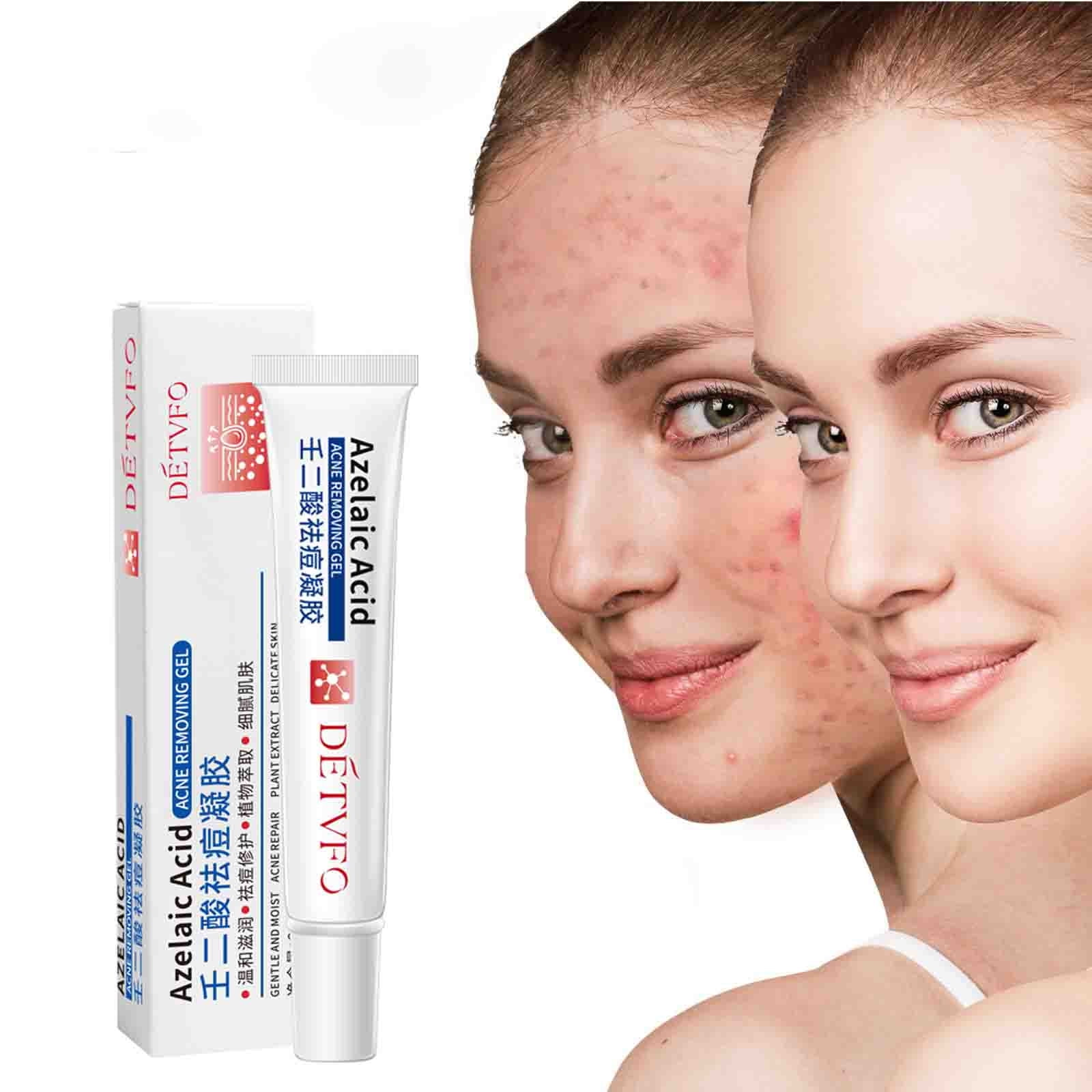Gzwccvsn PrescriptionStrength Topical Retinoid Gel For Face, Helps