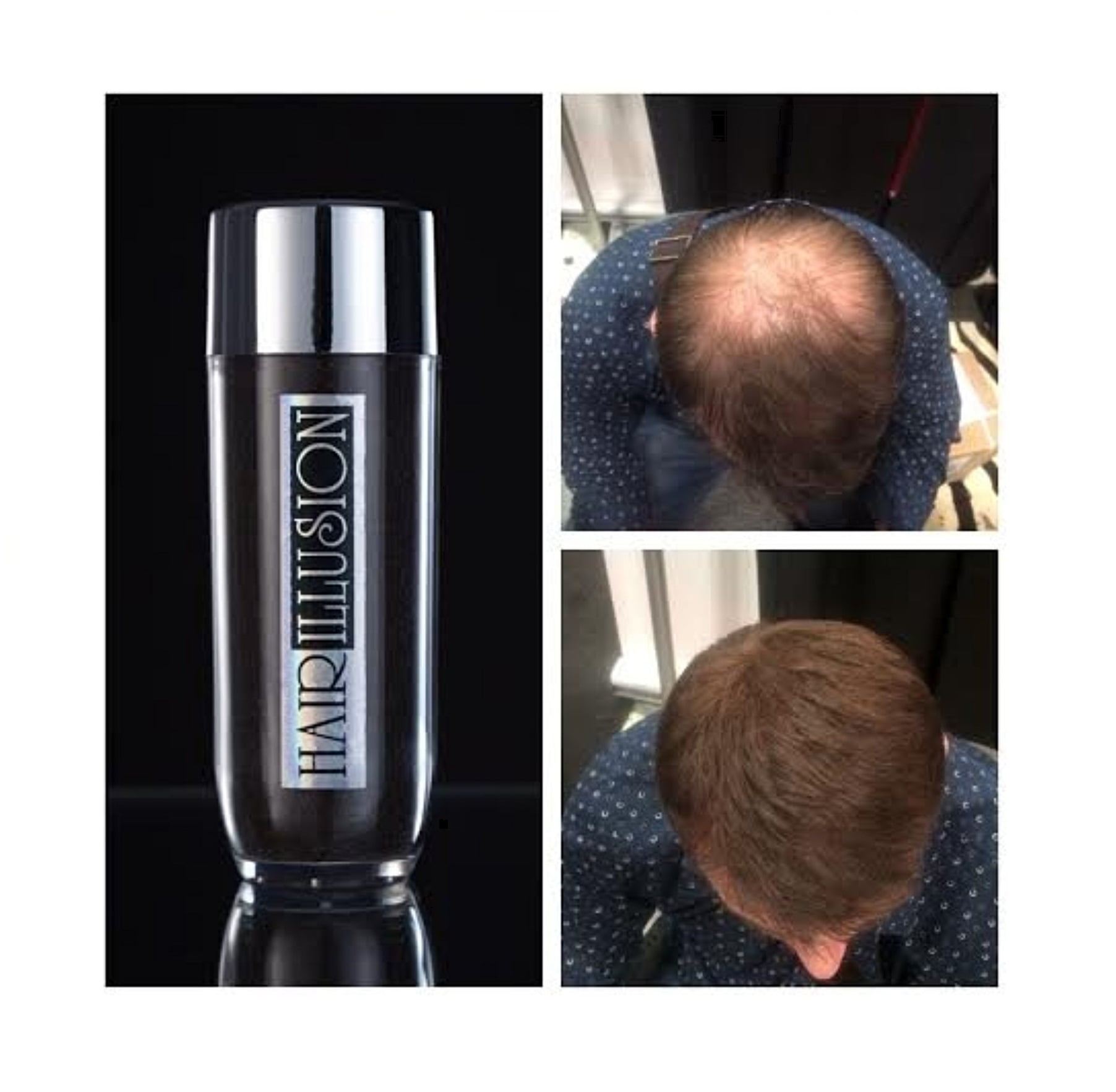 HAIR ILLUSION - 100% Real Human Hair Fibers - Not Synthetic - For Men & Women, Premium Hair Building Formulation, Brown - 38g