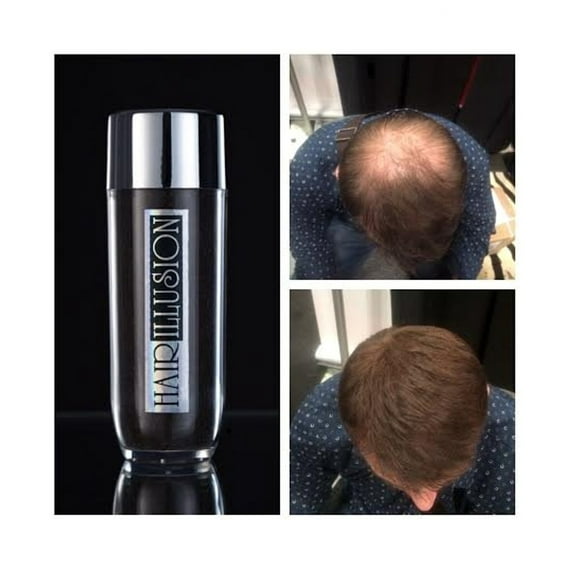 HAIR ILLUSION - 100% Real Human Hair Fibers - Not Synthetic - For Men & Women, Premium Hair Building Formulation, Brown - 38g