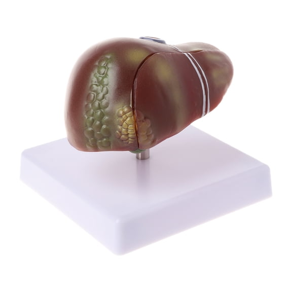 HEMLBOYW Human Liver Patgical Amical Model Amy School Teaching Displa Plastic