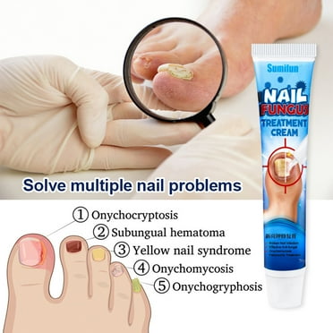 HICESS 20g Nail Repair Cream Fast Absorption Onychomycosis Treatment Mild Ingredients Anti Fungal Treatment Toe Finger Ointment for Adult