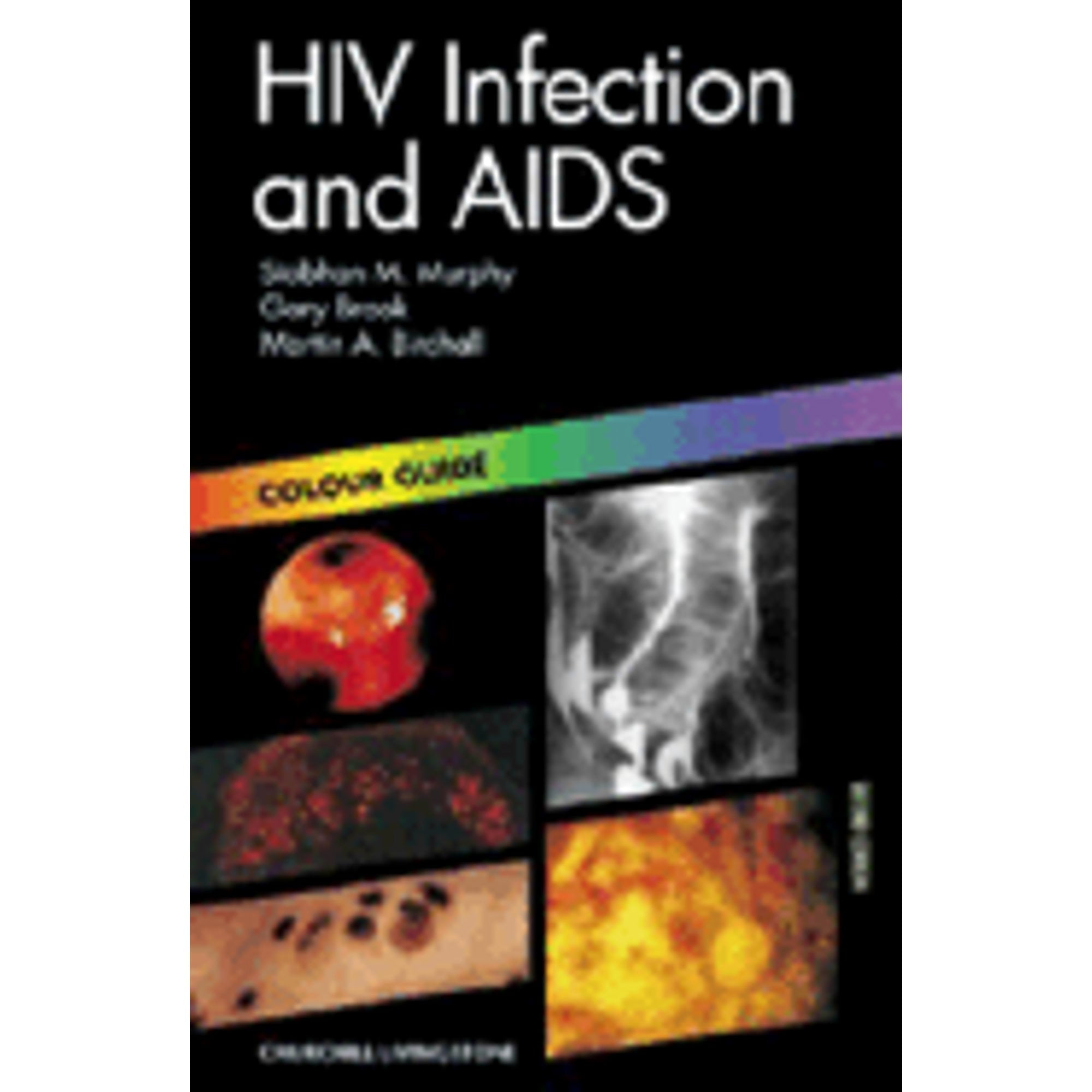 HIV Infection and AIDS: Colour Guide (Paperback) by Siobhan M Murphy ...