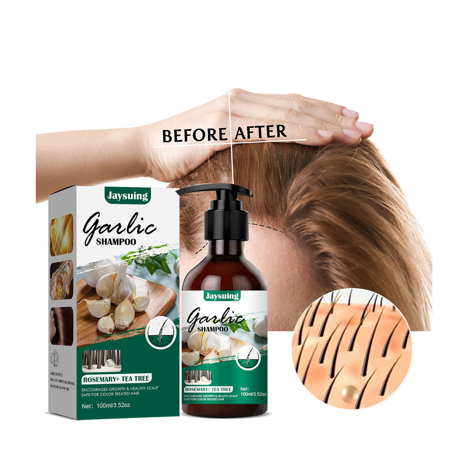 HMPEAIIY Plantar 49 for Hair Garlic Shampoo Dandruff dandruff Shampoo