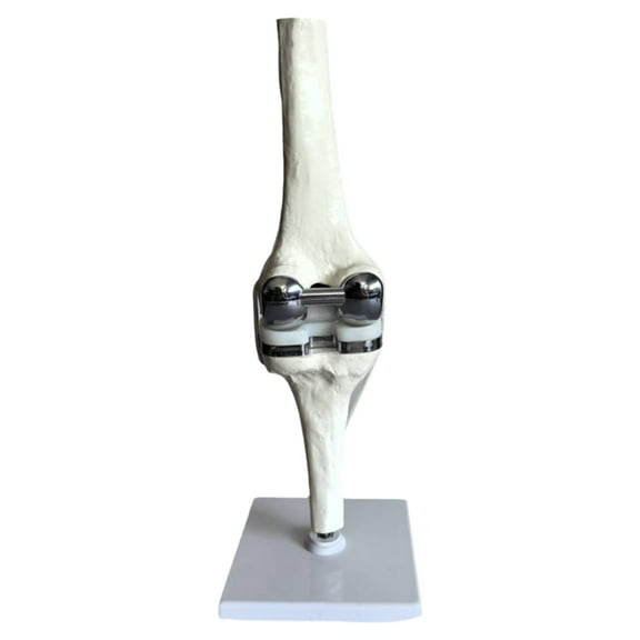 HOT Knee Joint Model Simulation Replacement Surgery Meniscus Ligament Cartilages Model,Artificial
