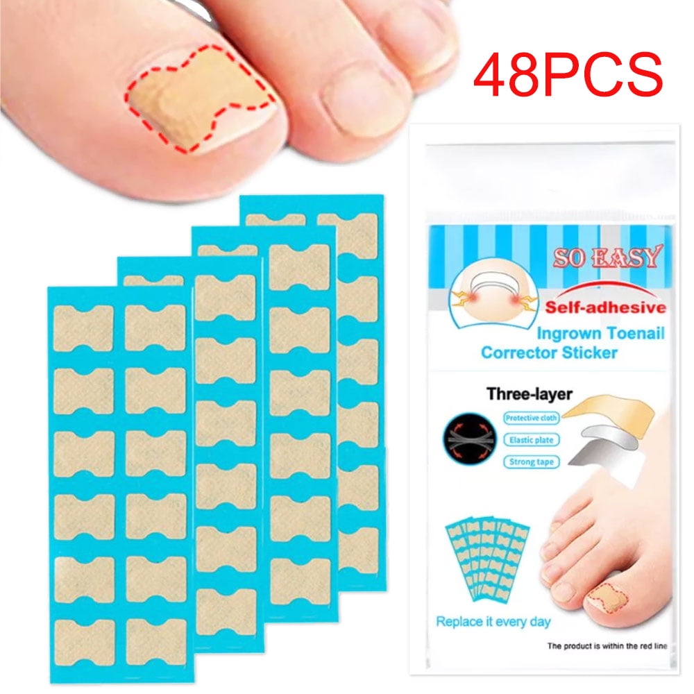 HOTBEST 48PCS Glue Free Toenail Patch Ingrown Toenail Patch Ingrowing
