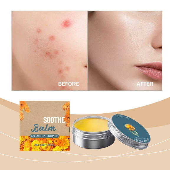 HWRETIE Redness Repair Balm,Soothing Skincare Cream for Men,Calming and Hydrating Facial Treatment 50g