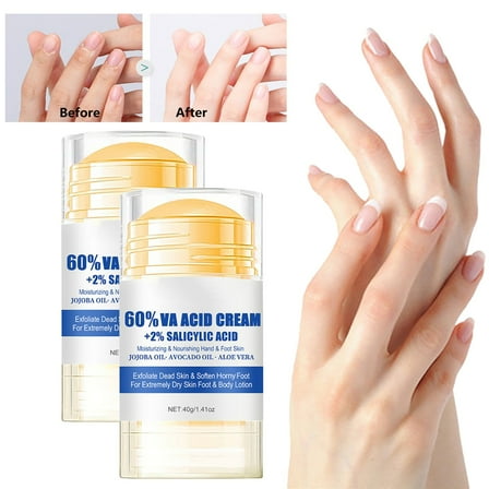 HYLLai 2pc Hand & Foot Moisturizing Cream, Deep Repair for Cracked Heels, Long-Lasting Hydration, Soothes Rough Skin, All Skin Types