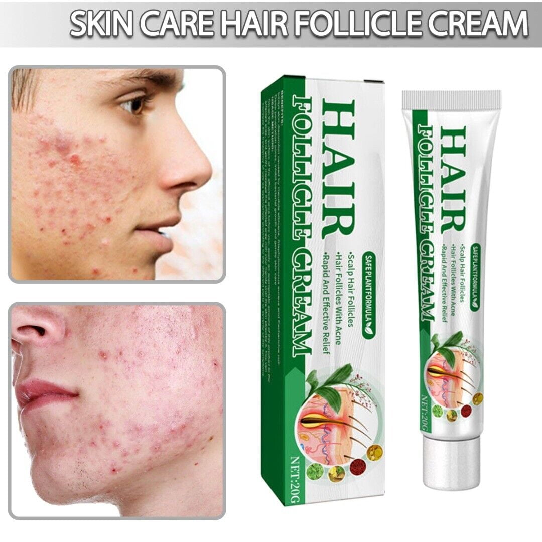 Hair Follicle Cream Folliculitis Cream Skin Care Natural Ingredients 20g