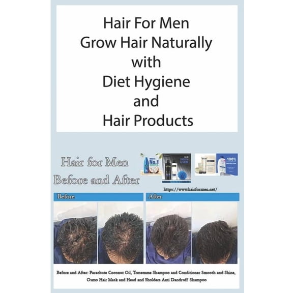 Hair For Men Grow Hair Naturally with Diet Hygiene and Hair Products, (Paperback)