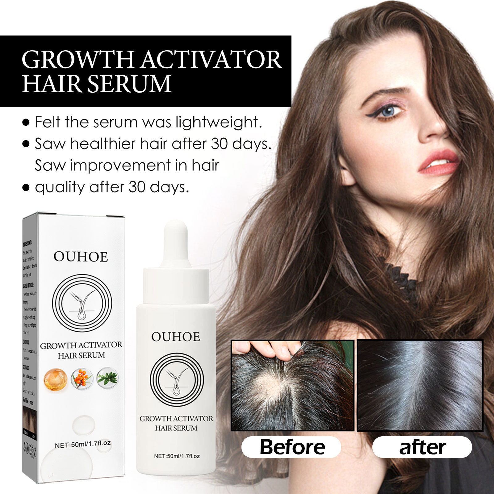 Hair Growth Activator Hair Growth Oil For Hair Loss For Women 50ml