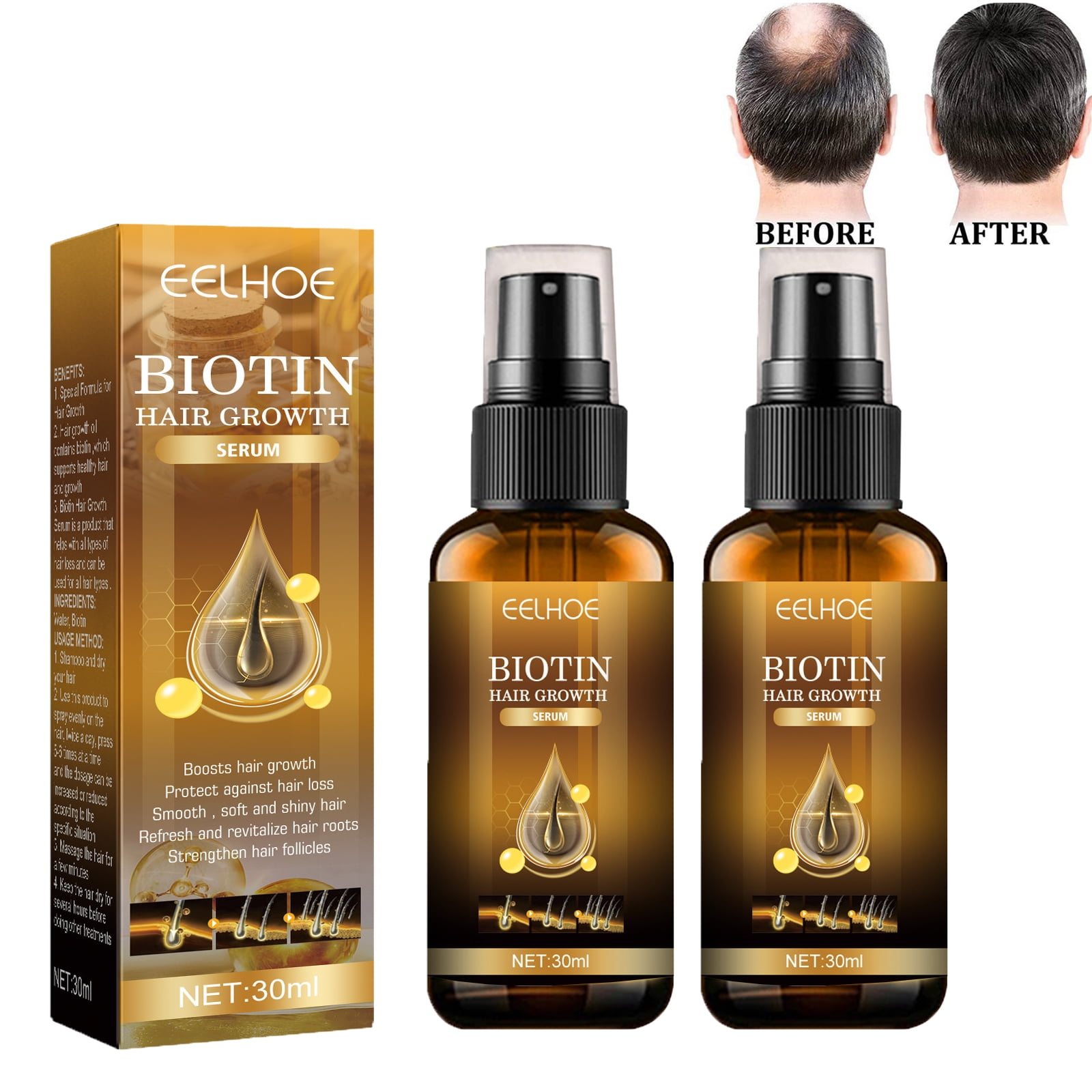 Hair Growth Oil Biotin Hair Growth Serum Hair Growth Kit Treatment For Stronger Thicker 0305