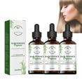 thumbnail image 1 of Hair Growth Oil, Hair Regrowth Essence, Hair Regrowth Treatment Advanced, Hair Regrowth Plant Extract Oil for Women Men (3pcs), 1 of 6