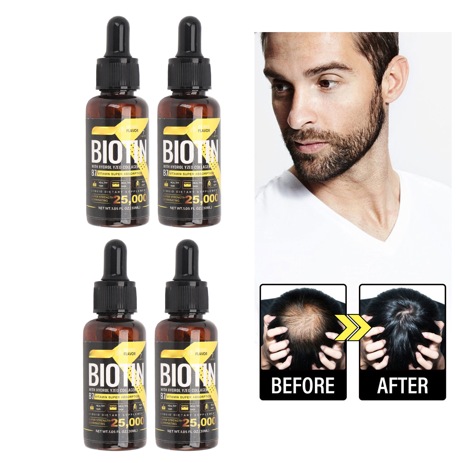 Hair Growth Oil, Moisturized Scalp 4pcs 30ml Nourish B7 Vitamin Hair