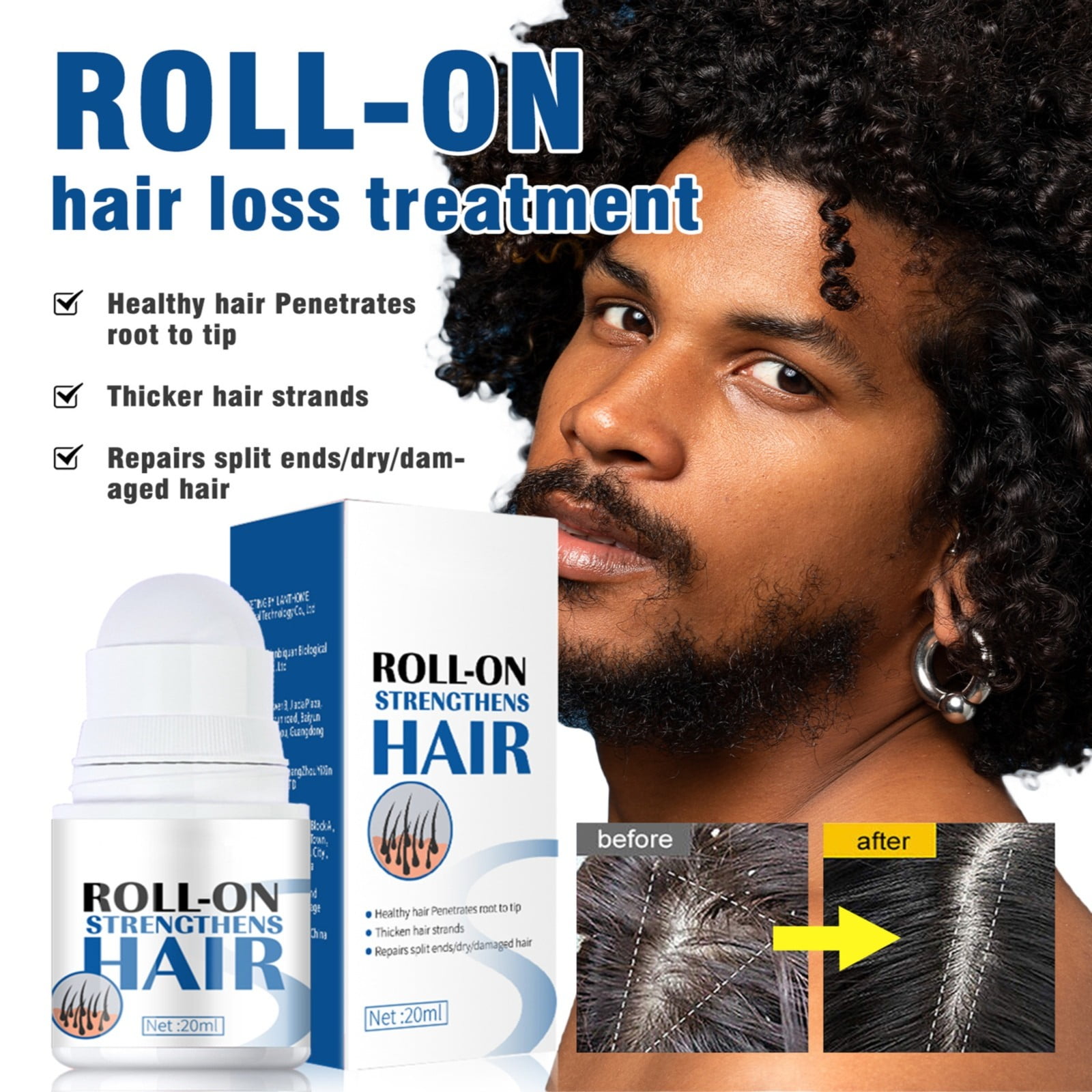 Hair X Roll On Hair Renewhair X Hair And Beard Regrowth Roll On