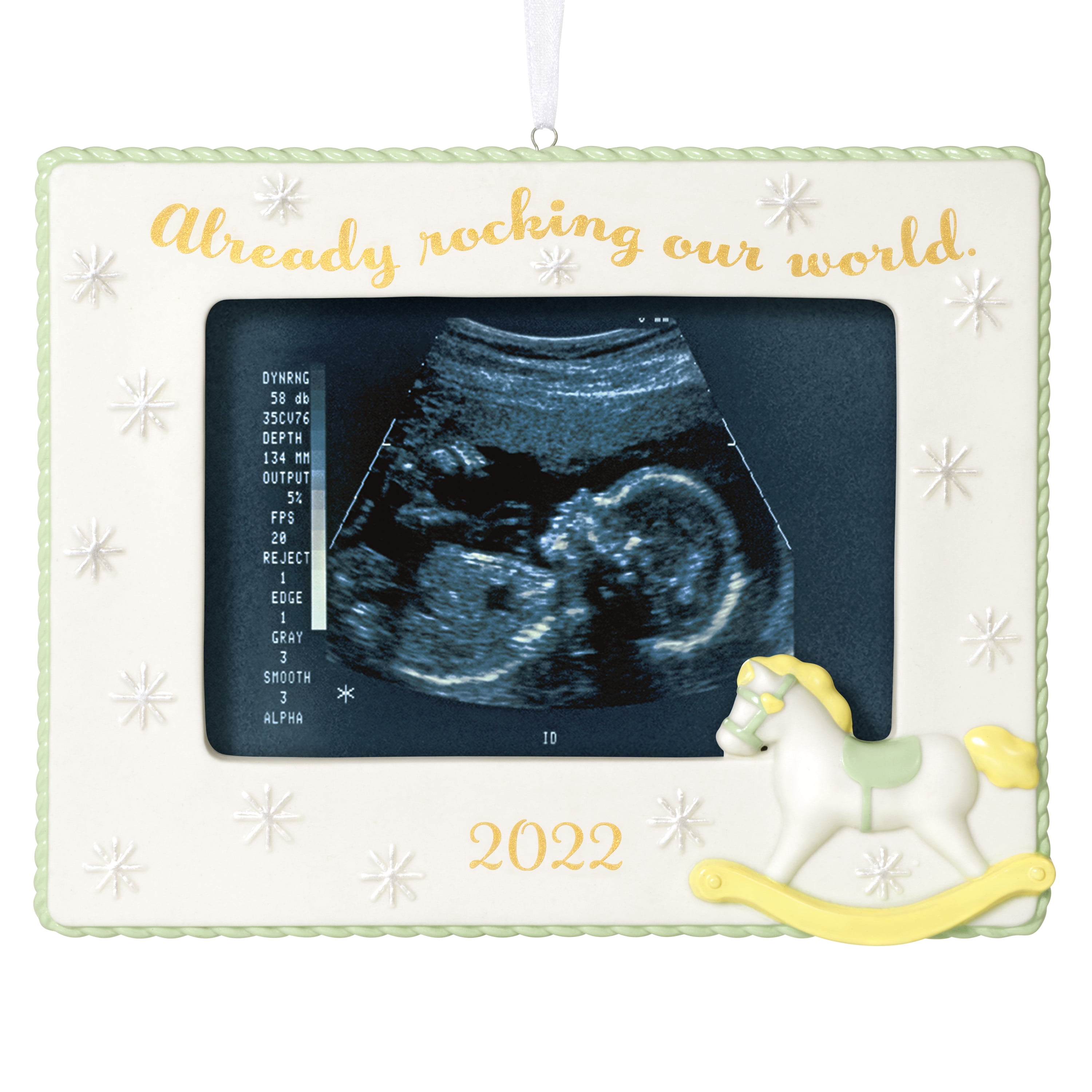 Ultrasound Tech Mug Sonographer Sonography Ultrasound Tech Gft