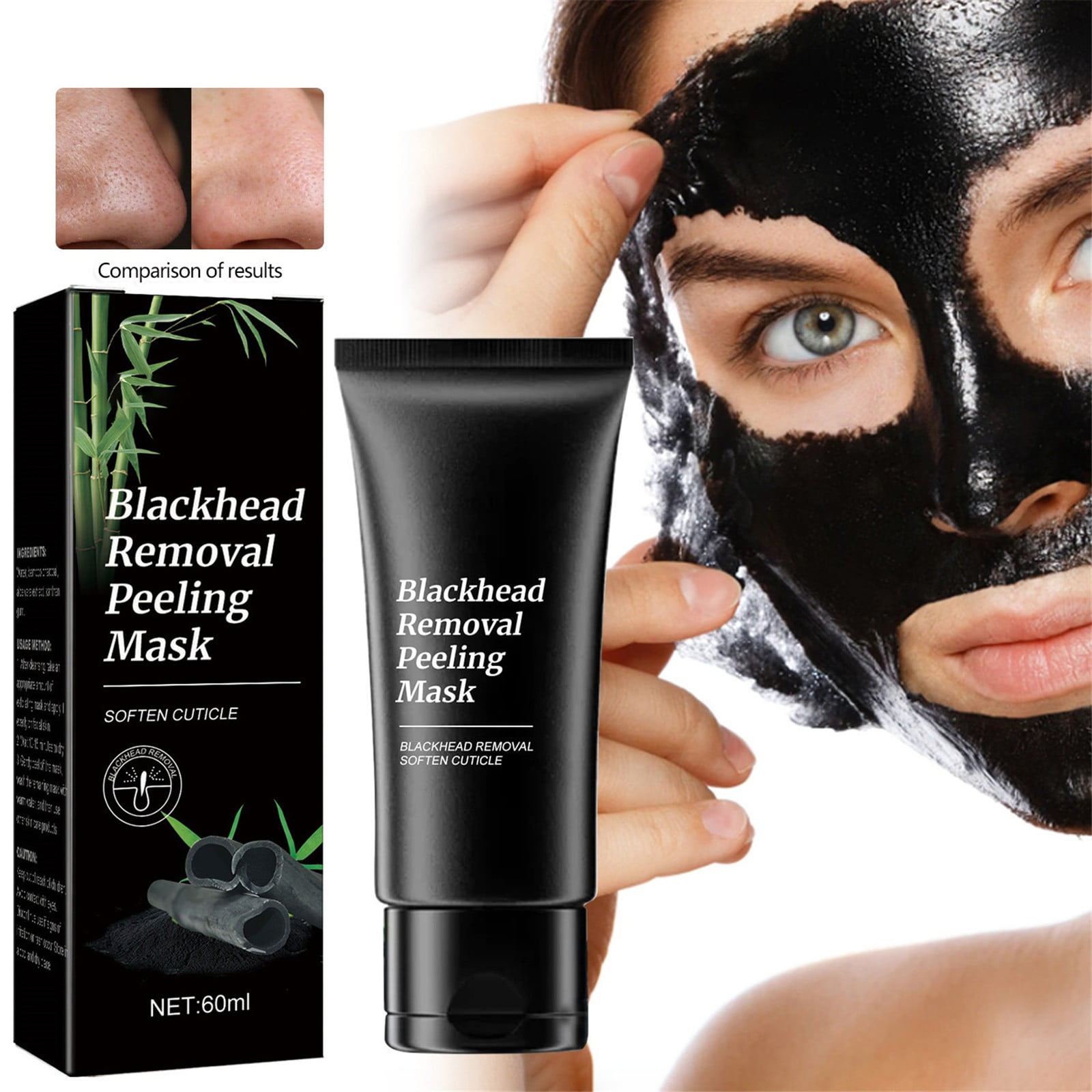 Newest Blackhead Removal Videos 2024 11 - o64nw9i