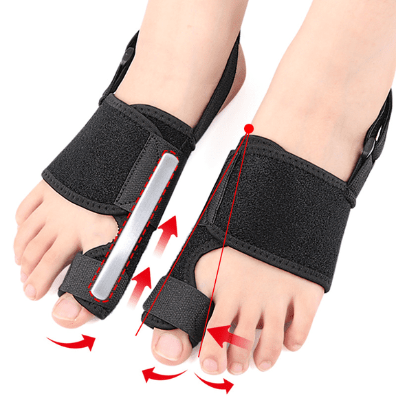Hallux Valgus Corrector Overlapping Toe Splint, Adjustable Day Night Fixing Brace Built-in Aluminum Strip,1PC
