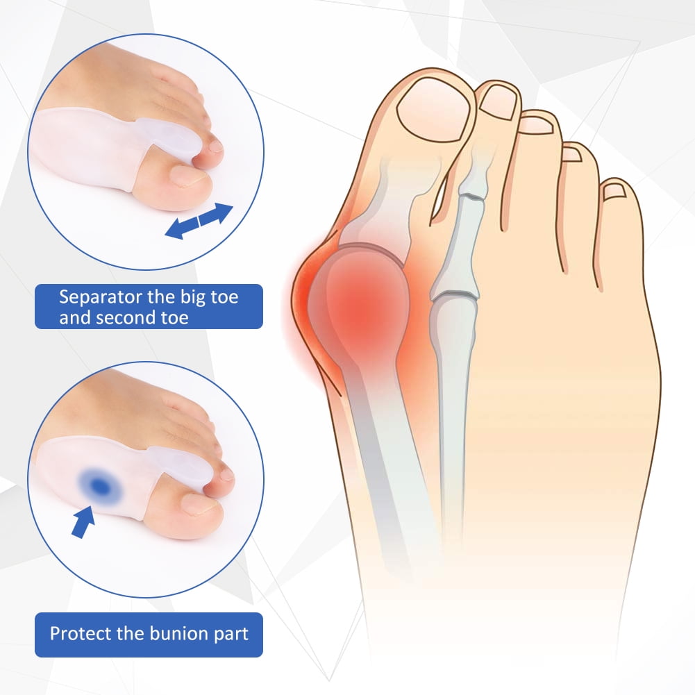 Orthopedic Hammer Toe Straightener Corrector, Big Toe Separator, Bunion ...