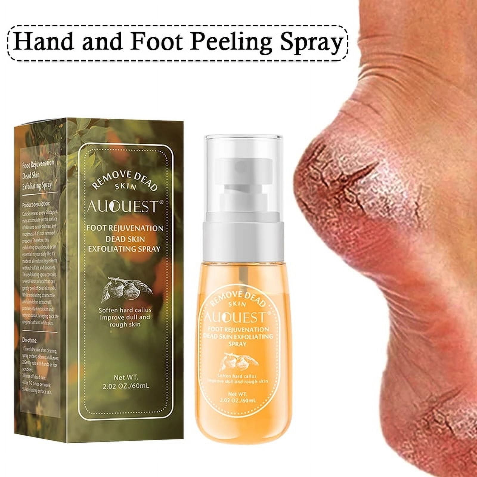 XIFEPFR Callus Remover, Foot Scrubber Dead Skin Remover, Exfoliating Foot  Spray, Spa Pedicure Treatment with Foot File, Cracked Heel Repair Cream