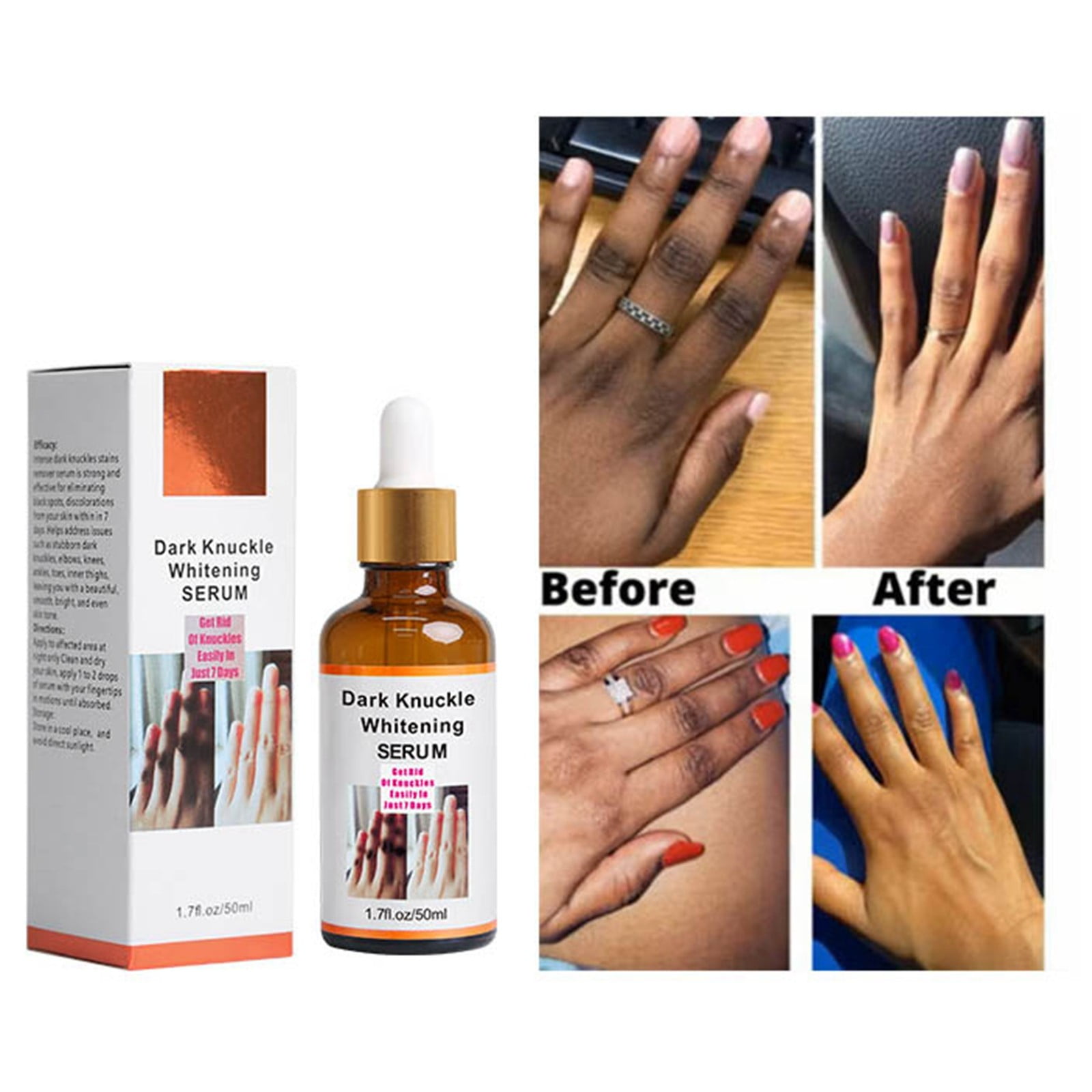 Hand Finger Joint 50ml Lightens Skin And Softens Cuticles Refreshing