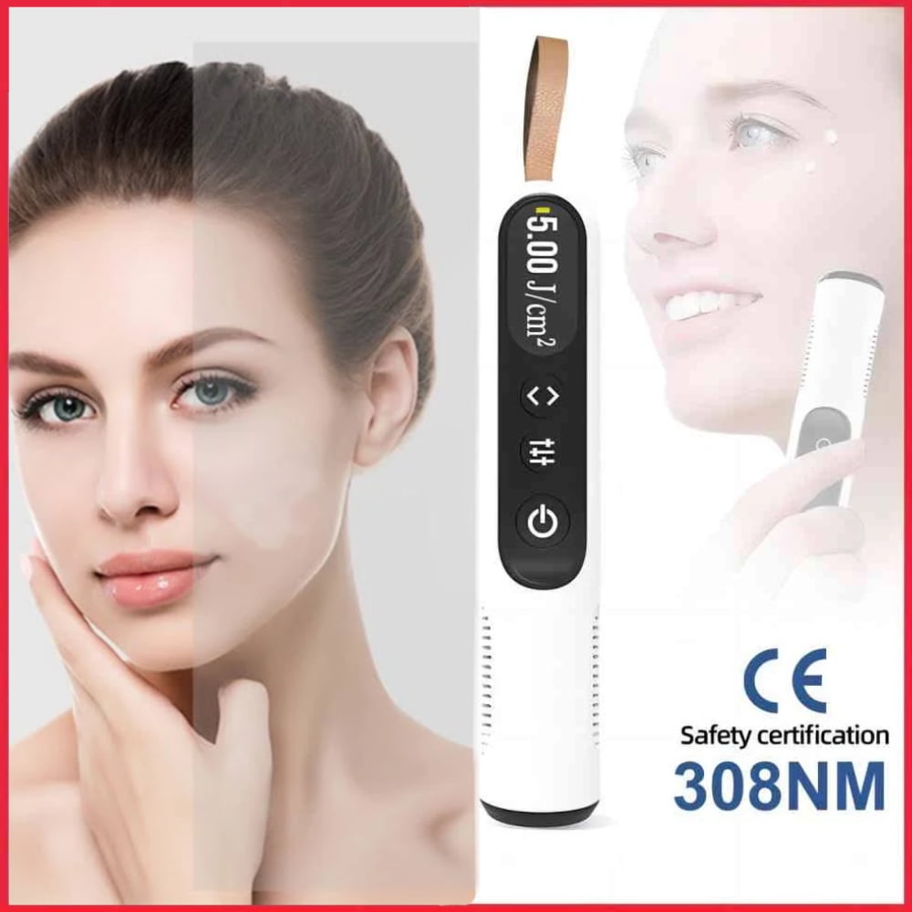 HandHeld UVB Ultraviolet Phototherapy Light 308NM Narrowband