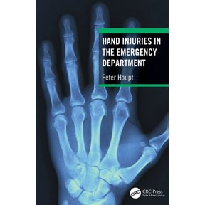 Hand Injuries in the Emergency Department, (Paperback)